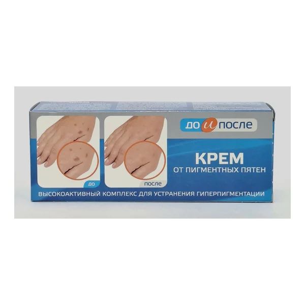 To and after cream against pigmentnykh pyaten 50ml Tvins Tek Russia