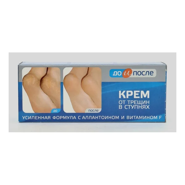 To and after cream for cracks in stupnyakh 50ml Tvins Tek Russia