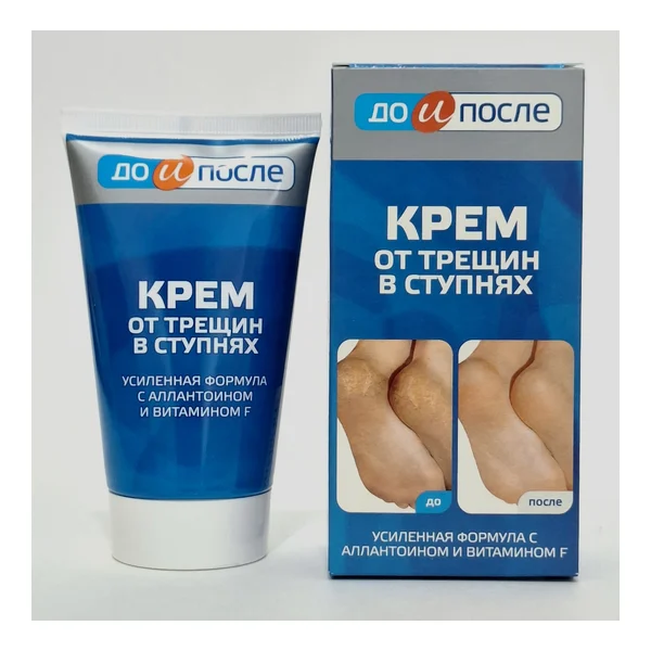 To and after cream for cracks in stupnyakh 150ml Tvins Tek Russia